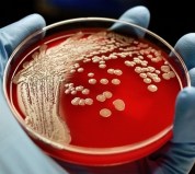 Agar Plate with Colonies cropped6